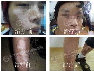 ���ʰ����ٴ��������Ƚ��������������硿Recellϸ��������